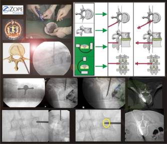 enterpage-vertebro-fl-vl.jpg